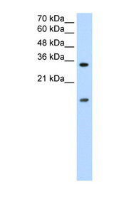 HNRNPUL1 Antibody - HNRNPUL1 / HNRPUL1 antibody Western blot of Jurkat lysate. This image was taken for the unconjugated form of this product. Other forms have not been tested.