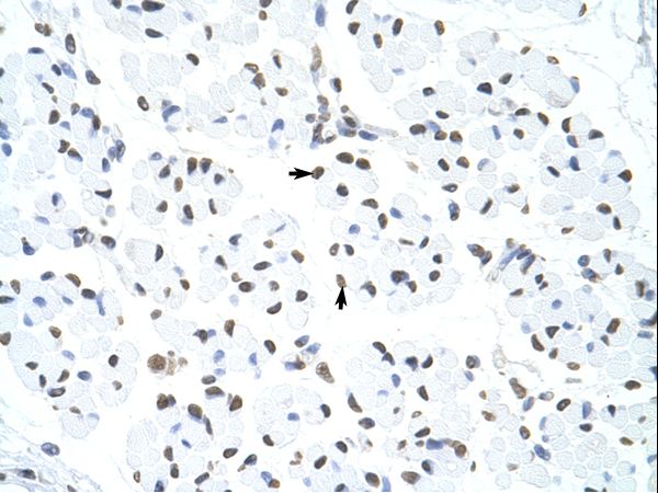 HNRNPUL1 Antibody - HNRNPUL1 / HNRPUL1 antibody ARP40702_T100-NP_653333-HNRPUL1 (heterogeneous nuclear ribonucleoprotein U-like 1) Antibody was used in IHC to stain formalin-fixed, paraffin-embedded human muscle.  This image was taken for the unconjugated form of this product. Other forms have not been tested.