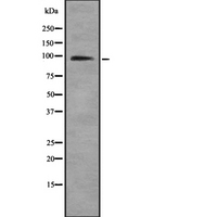HNRNPUL1 Antibody - Western blot analysis of HNRNPUL1 using COLO205 whole lysates.