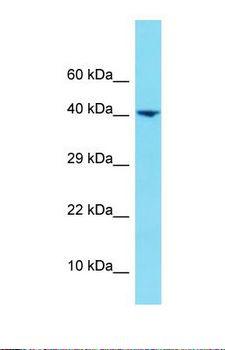 HNRNPUL1 Antibody - Western blot of Human COLO205. HNRNPUL1 antibody dilution 1.0 ug/ml.  This image was taken for the unconjugated form of this product. Other forms have not been tested.