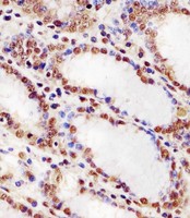 HNRNPUL2 Antibody - Antibody staining HNRNPUL2 in human stomach tissue sections by Immunohistochemistry (IHC-P - paraformaldehyde-fixed, paraffin-embedded sections). Tissue was fixed with formaldehyde and blocked with 3% BSA for 0. 5 hour at room temperature; antigen retrieval was by heat mediation with a citrate buffer (pH 6). Samples were incubated with primary antibody (1:25) for 1 hours at 37°C. A undiluted biotinylated goat polyvalent antibody was used as the secondary antibody.