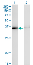 HNRPA1 / HnRNP A1 Antibody - Western Blot analysis of HNRNPA1 expression in transfected 293T cell line by HNRPA1 monoclonal antibody (M02), clone 2E6.Lane 1: HNRNPA1 transfected lysate(34.2 KDa).Lane 2: Non-transfected lysate.
