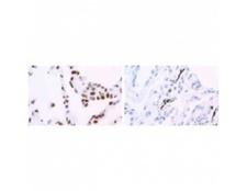 HNRPA1 / HnRNP A1 Antibody - Immunohistochemistry (Formalin/PFA-fixed paraffin-embedded sections)-hnRNP A1 antibody [9H10] staining human lung. Staining is localized to the nucleus.