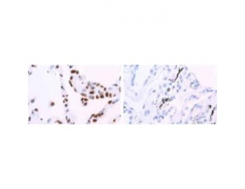 HNRPA1 / HnRNP A1 Antibody - Immunohistochemistry (Formalin/PFA-fixed paraffin-embedded sections)-hnRNP A1 antibody [9H10] staining human lung. Staining is localized to the nucleus.