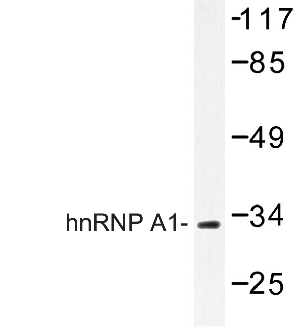 HNRPA1 / HnRNP A1 Antibody - Western blot of hnRNP A1 (E85) pAb in extracts from 293 cells.