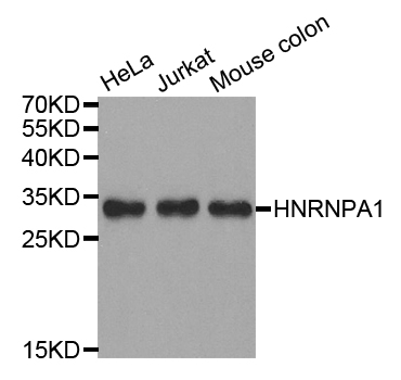 HNRPA1 / HnRNP A1 Antibody - Western blot analysis of extracts of various cell lines.