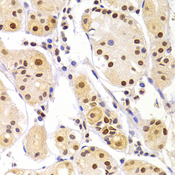 HNRPA1 / HnRNP A1 Antibody - Immunohistochemistry of paraffin-embedded human gastric injury tissue.