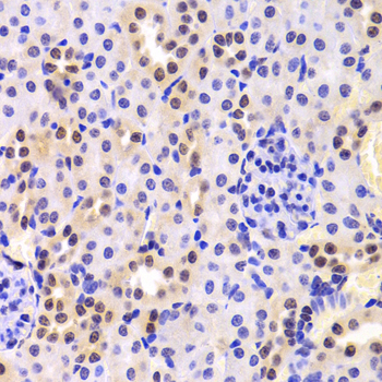 HNRPA1 / HnRNP A1 Antibody - Immunohistochemistry of paraffin-embedded mouse kidney tissue.