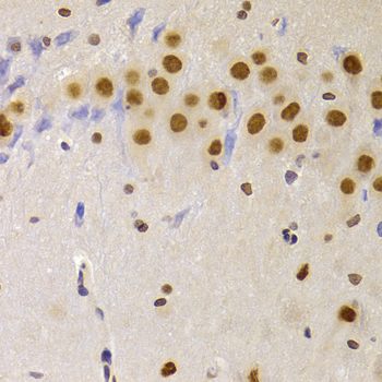 HNRPA1 / HnRNP A1 Antibody - Immunohistochemistry of paraffin-embedded rat brain tissue.