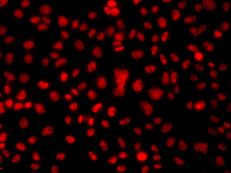HNRPA1 / HnRNP A1 Antibody - Immunofluorescence analysis of A549 cells.