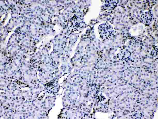 HNRPA1 / HnRNP A1 Antibody - HnRNP A1 was detected in paraffin-embedded sections of mouse kidney tissues using rabbit anti- HnRNP A1 Antigen Affinity purified polyclonal antibody