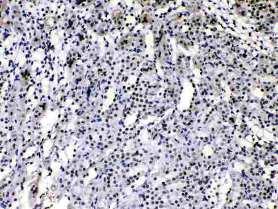 HNRPA1 / HnRNP A1 Antibody - HnRNP A1 was detected in paraffin-embedded sections of rat kidney tissues using rabbit anti- HnRNP A1 Antigen Affinity purified polyclonal antibody