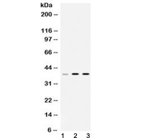 HNRPA1 / HnRNP A1 Antibody - Western blot testing of 1) rat liver, 2) mouse thymus and 3) human HeLa lysate with hnRNP A1 antibody at 0.5ug/ml. Predicted molecular weight ~39 kDa.