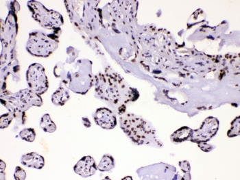 HNRPA1 / HnRNP A1 Antibody - IHC testing of human placental tissue with hnRNP A1 antibody at 1ug/ml. HIER: steam section in pH6 citrate buffer for 20 min.