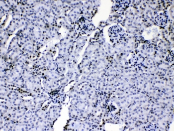 HNRPA1 / HnRNP A1 Antibody - IHC testing of mouse kidney tissue with hnRNP A1 antibody at 1ug/ml. HIER: steam section in pH6 citrate buffer for 20 min.