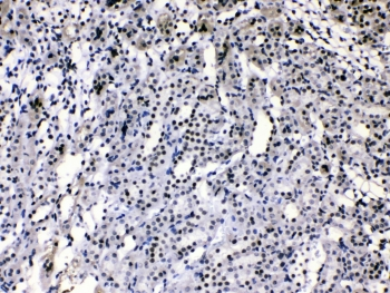 HNRPA1 / HnRNP A1 Antibody - IHC testing of rat kidney tissue with hnRNP A1 antibody at 1ug/ml. HIER: steam section in pH6 citrate buffer for 20 min.