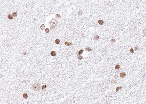 HNRPA1 / HnRNP A1 Antibody - 1:100 staining human brain tissue by IHC-P. The tissue was formaldehyde fixed and a heat mediated antigen retrieval step in citrate buffer was performed. The tissue was then blocked and incubated with the antibody for 1.5 hours at 22°C. An HRP conjugated goat anti-rabbit antibody was used as the secondary.