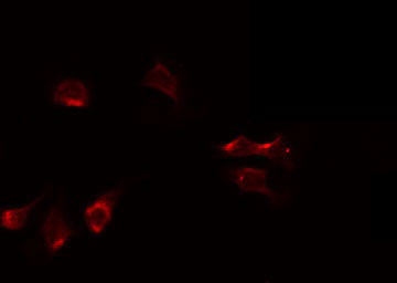 HNRPA1 / HnRNP A1 Antibody