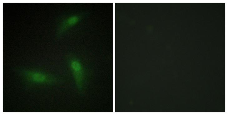 HNRPA1 / HnRNP A1 Antibody - Peptide - + Immunofluorescence analysis of HeLa cells, using hnRNP A1 antibody.
