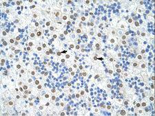 HNRPA1 / HnRNP A1 Antibody - HNRNPA1 / HnRNP A1 antibody ARP40383_T100-NP_002127-HNRPA1 (heterogeneous nuclear ribonucleoprotein A1) Antibody was used in IHC to stain formalin-fixed, paraffin-embedded human liver.  This image was taken for the unconjugated form of this product. Other forms have not been tested.