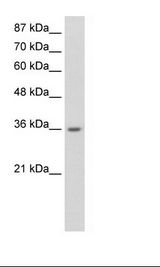 HNRPA1 / HnRNP A1 Antibody - Jurkat Cell Lysate.  This image was taken for the unconjugated form of this product. Other forms have not been tested.