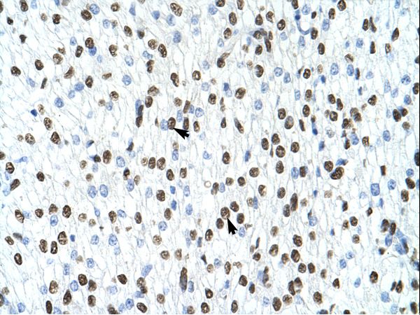 HNRPA1 / HnRNP A1 Antibody - HNRNPA1 / HnRNP A1 antibody ARP40383_T100-NP_002127-HNRPA1 (heterogeneous nuclear ribonucleoprotein A1) Antibody was used in IHC to stain formalin-fixed, paraffin-embedded human heart.  This image was taken for the unconjugated form of this product. Other forms have not been tested.