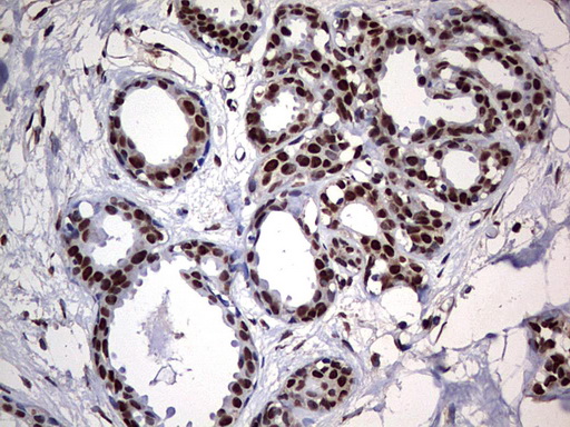 HNRPM / HNRNPM Antibody - IHC of paraffin-embedded Human breast tissue using anti-HNRNPM mouse monoclonal antibody. (Heat-induced epitope retrieval by 1 mM EDTA in 10mM Tris, pH9.0, 120°C for 3min).