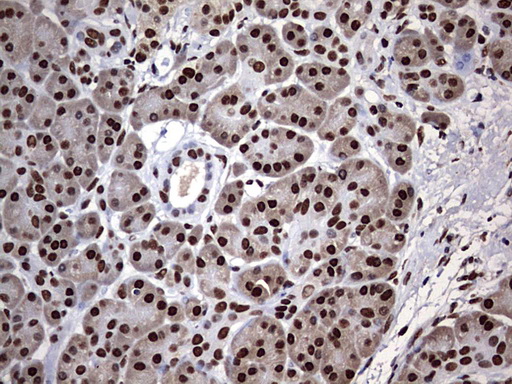 HNRPM / HNRNPM Antibody - IHC of paraffin-embedded Human pancreas tissue using anti-HNRNPM mouse monoclonal antibody. (Heat-induced epitope retrieval by 1 mM EDTA in 10mM Tris, pH9.0, 120°C for 3min).