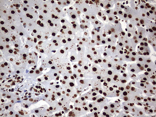 HNRPM / HNRNPM Antibody - IHC of paraffin-embedded Human liver tissue using anti-HNRNPM mouse monoclonal antibody. (Heat-induced epitope retrieval by 1 mM EDTA in 10mM Tris, pH9.0, 120°C for 3min).