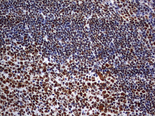 HNRPM / HNRNPM Antibody - IHC of paraffin-embedded Human tonsil using anti-HNRNPM mouse monoclonal antibody. (Heat-induced epitope retrieval by 1 mM EDTA in 10mM Tris, pH9.0, 120°C for 3min).