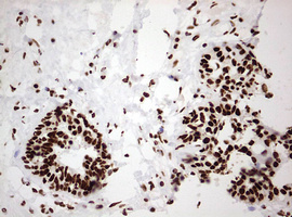 HNRPM / HNRNPM Antibody - IHC of paraffin-embedded Human breast tissue using anti-HNRNPM mouse monoclonal antibody. (Heat-induced epitope retrieval by 10mM citric buffer, pH6.0, 120°C for 3min).
