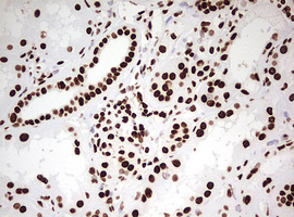 HNRPM / HNRNPM Antibody - IHC of paraffin-embedded Human Kidney tissue using anti-HNRNPM mouse monoclonal antibody. (Heat-induced epitope retrieval by 10mM citric buffer, pH6.0, 120°C for 3min).