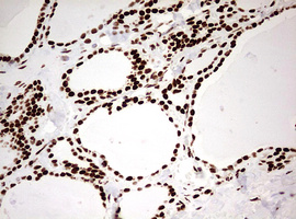 HNRPM / HNRNPM Antibody - IHC of paraffin-embedded Human thyroid tissue using anti-HNRNPM mouse monoclonal antibody. (Heat-induced epitope retrieval by 10mM citric buffer, pH6.0, 120°C for 3min).