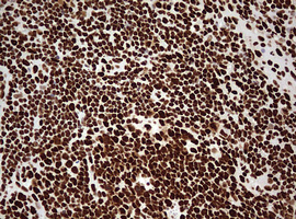 HNRPM / HNRNPM Antibody - IHC of paraffin-embedded Human lymph node tissue using anti-HNRNPM mouse monoclonal antibody. (Heat-induced epitope retrieval by 10mM citric buffer, pH6.0, 120°C for 3min).