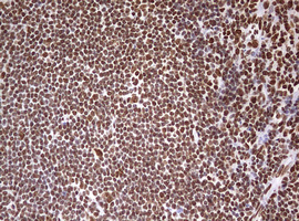 HNRPM / HNRNPM Antibody - IHC of paraffin-embedded Human tonsil using anti-HNRNPM mouse monoclonal antibody. (Heat-induced epitope retrieval by 10mM citric buffer, pH6.0, 120°C for 3min).