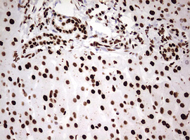 HNRPM / HNRNPM Antibody - IHC of paraffin-embedded Human liver tissue using anti-HNRNPM mouse monoclonal antibody. (Heat-induced epitope retrieval by 10mM citric buffer, pH6.0, 120°C for 3min).