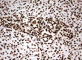 HNRPM / HNRNPM Antibody - IHC of paraffin-embedded Human pancreas tissue using anti-HNRNPM mouse monoclonal antibody. (Heat-induced epitope retrieval by 10mM citric buffer, pH6.0, 120°C for 3min).
