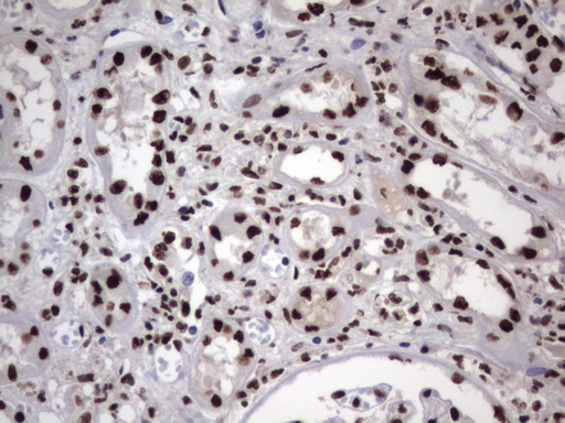 HNRPM / HNRNPM Antibody - IHC of paraffin-embedded Human Kidney tissue using anti-HNRNPM mouse monoclonal antibody. (Heat-induced epitope retrieval by 1 mM EDTA in 10mM Tris, pH8.5, 120°C for 3min).