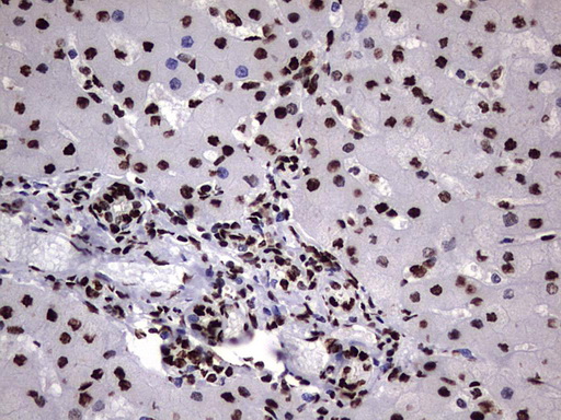 HNRPM / HNRNPM Antibody - IHC of paraffin-embedded Human liver tissue using anti-HNRNPM mouse monoclonal antibody. (Heat-induced epitope retrieval by 1 mM EDTA in 10mM Tris, pH8.5, 120°C for 3min).