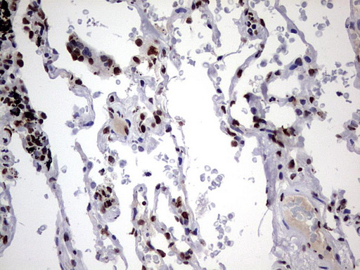 HNRPM / HNRNPM Antibody - IHC of paraffin-embedded Human lung tissue using anti-HNRNPM mouse monoclonal antibody. (Heat-induced epitope retrieval by 1 mM EDTA in 10mM Tris, pH8.5, 120°C for 3min).