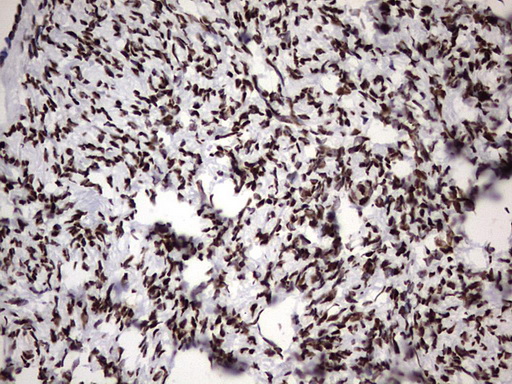 HNRPM / HNRNPM Antibody - IHC of paraffin-embedded Human Ovary tissue using anti-HNRNPM mouse monoclonal antibody. (Heat-induced epitope retrieval by 1 mM EDTA in 10mM Tris, pH8.5, 120°C for 3min).