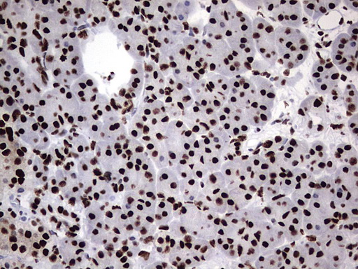 HNRPM / HNRNPM Antibody - IHC of paraffin-embedded Human pancreas tissue using anti-HNRNPM mouse monoclonal antibody. (Heat-induced epitope retrieval by 1 mM EDTA in 10mM Tris, pH8.5, 120°C for 3min).