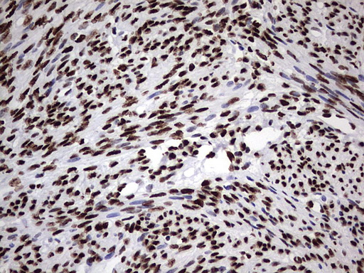 HNRPM / HNRNPM Antibody - IHC of paraffin-embedded Human endometrium tissue using anti-HNRNPM mouse monoclonal antibody. (Heat-induced epitope retrieval by 1 mM EDTA in 10mM Tris, pH8.5, 120°C for 3min).