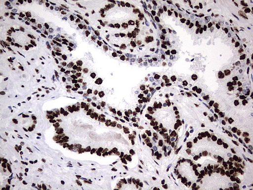 HNRPM / HNRNPM Antibody - IHC of paraffin-embedded Human prostate tissue using anti-HNRNPM mouse monoclonal antibody. (Heat-induced epitope retrieval by 1 mM EDTA in 10mM Tris, pH8.5, 120°C for 3min).