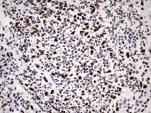 HNRPM / HNRNPM Antibody - IHC of paraffin-embedded Human lymph node tissue using anti-HNRNPM mouse monoclonal antibody. (Heat-induced epitope retrieval by 1 mM EDTA in 10mM Tris, pH8.5, 120°C for 3min).