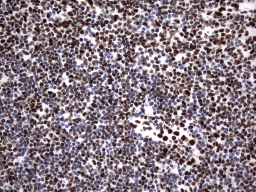HNRPM / HNRNPM Antibody - IHC of paraffin-embedded Human tonsil using anti-HNRNPM mouse monoclonal antibody. (Heat-induced epitope retrieval by 1 mM EDTA in 10mM Tris, pH8.5, 120°C for 3min).