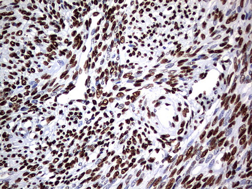 HNRPM / HNRNPM Antibody - IHC of paraffin-embedded Human endometrium tissue using anti-HNRNPM mouse monoclonal antibody. (Heat-induced epitope retrieval by 1 mM EDTA in 10mM Tris, pH9.0, 120°C for 3min).