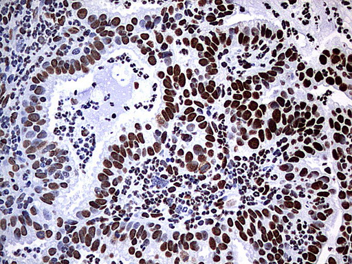 HNRPM / HNRNPM Antibody - IHC of paraffin-embedded Human lymph node tissue using anti-HNRNPM mouse monoclonal antibody. (Heat-induced epitope retrieval by 1 mM EDTA in 10mM Tris, pH9.0, 120°C for 3min).