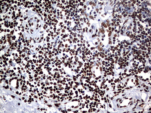 HNRPM / HNRNPM Antibody - IHC of paraffin-embedded Human tonsil using anti-HNRNPM mouse monoclonal antibody. (Heat-induced epitope retrieval by 1 mM EDTA in 10mM Tris, pH9.0, 120°C for 3min).