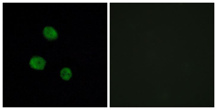 HNRPM / HNRNPM Antibody - Immunofluorescence analysis of MCF7 cells, using hnRNP M Antibody. The picture on the right is blocked with the synthesized peptide.